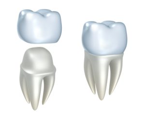 dental crown procedure Laurel Maryland