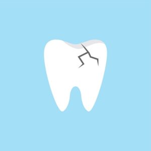 Treatment Options for Tooth Breakage