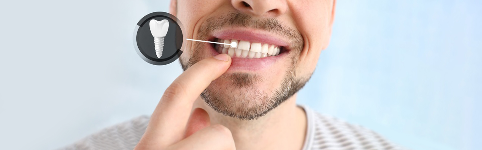 Implant Dentist 20707
