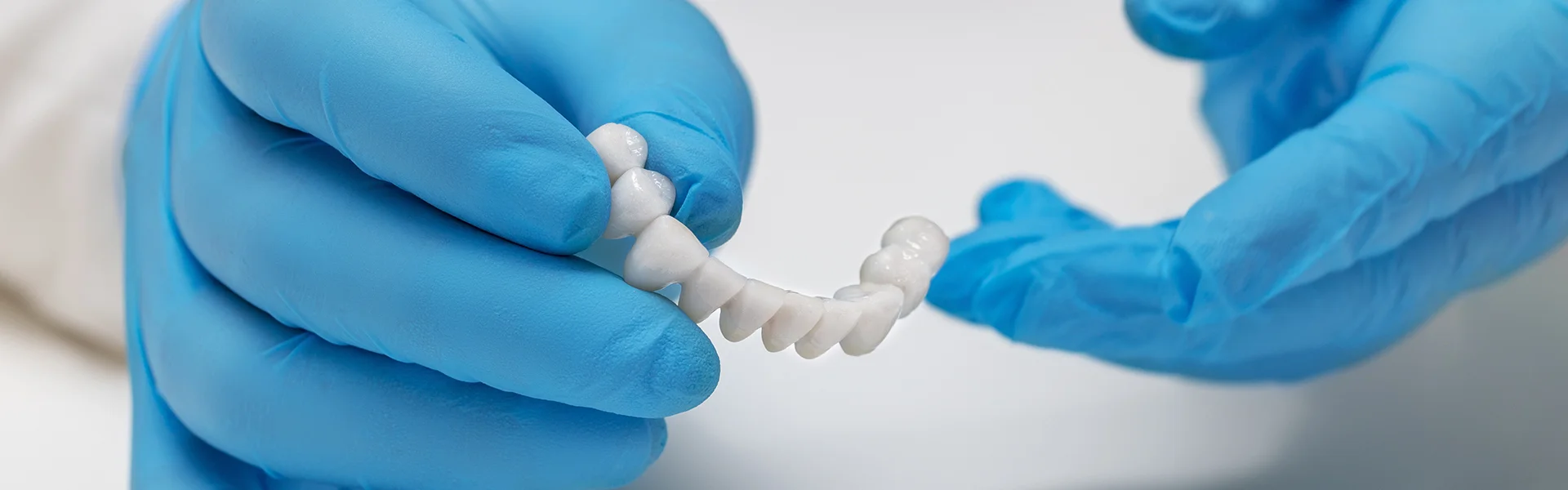 Natural-looking dental bridge