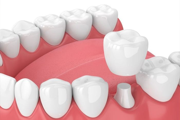 Implant Dentist 20707